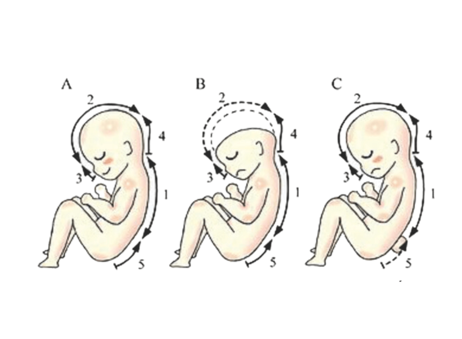 Những điều cần biết về dị tật bẩm sinh ở thai nhi